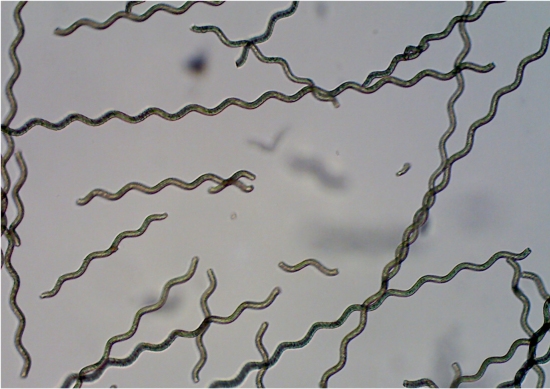 Microrrobôs feitos com alga tratam doença em cobaias