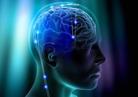 Pesquisadores conseguem implantar dispositivo cerebral para tratar ataques de epilepsia