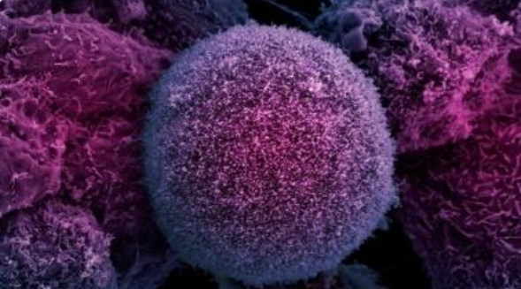 Pesquisadores criam IA capaz de diferenciar células cancerígenas das saudáveis