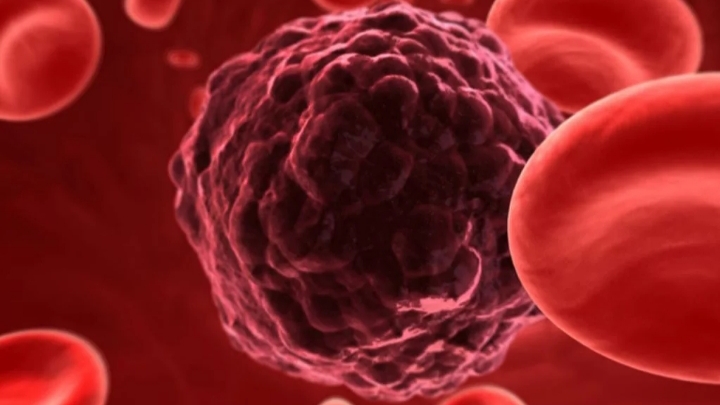 Novo chip detecta câncer em uma gota de sangue