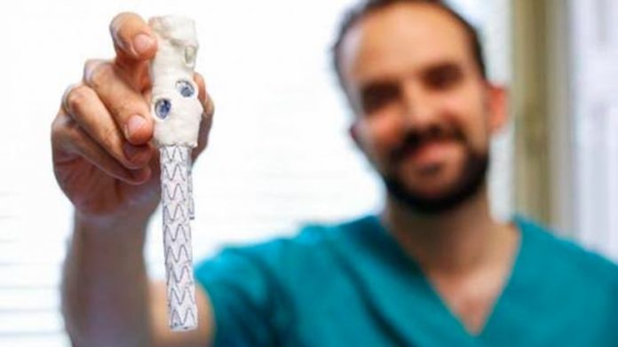 Aorta impressa em 3D fabricada em menos de 10 horas salva vida de paciente espanhol