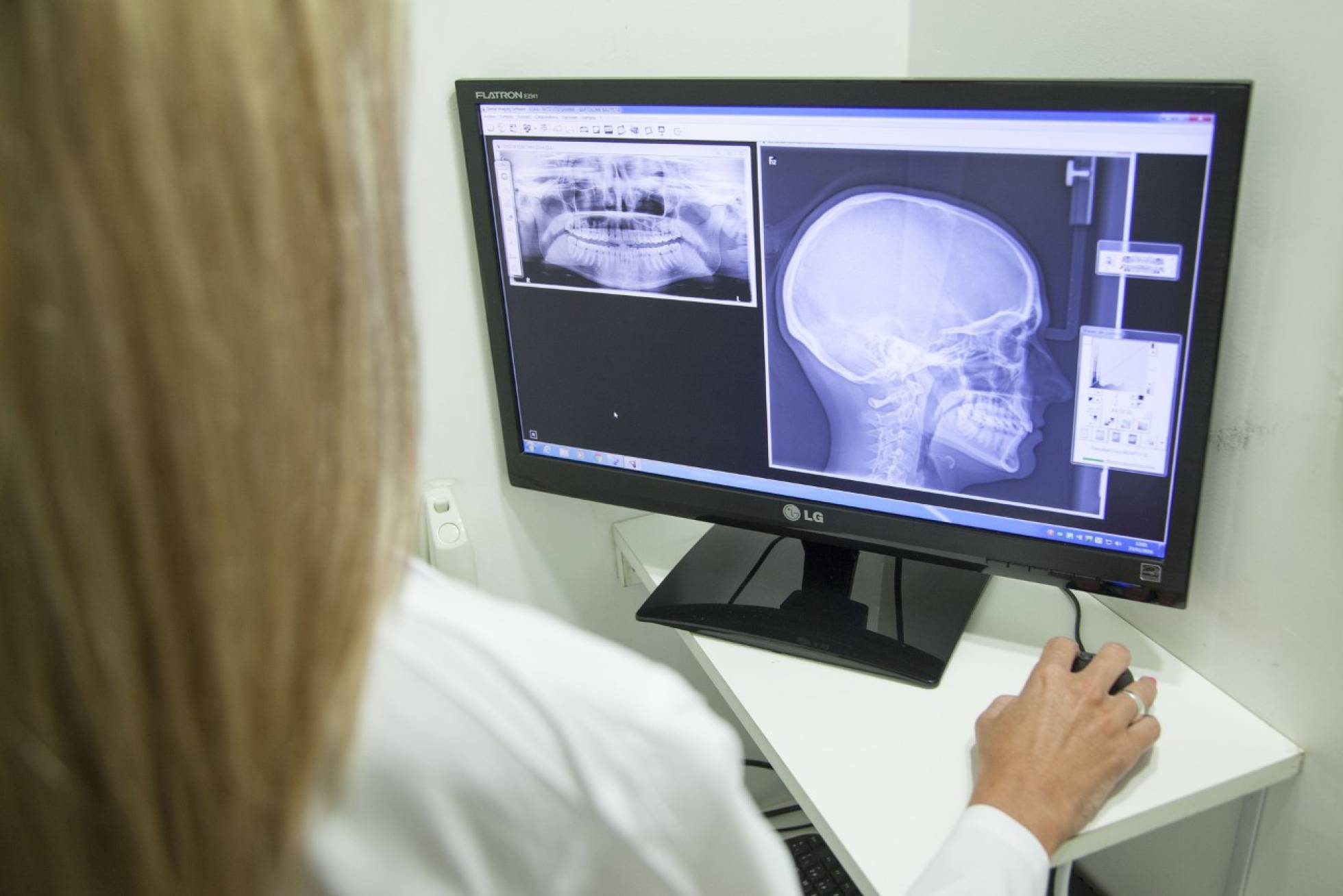 La inteligencia artificial permite reconstruir imágenes médicas en 3D a partir de fotografías