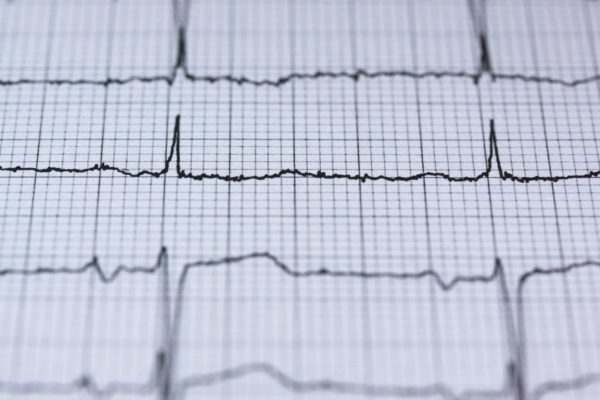 Variabilidade de frequência cardíaca e processamento de sinais na medicina